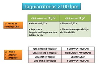 Taquiarritmias >100 lpm
QRS estrecho TQSV QRS ancho TQV
• Menos de 0,12 s
• Se produce
despolarización por encima
del Haz de His
• Mayor a 0,12 s
• Generalmente por debajo
del Haz de His
1.- Ancho de
complejo QRS
2.- Ritmo
• Regular
• Irregular
QRS estrecho y regular SUPRAVENTRICULAR
QRS estrecho e irregular FIBRILACIÓN AURICULAR
QRS ancho y regular VENTRICULAR
QRS ancho e irregular SUPRAVENTRICULAR
 