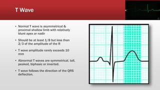 Normal T Wave Parameters ECG(EKG) BASICS | PPTX