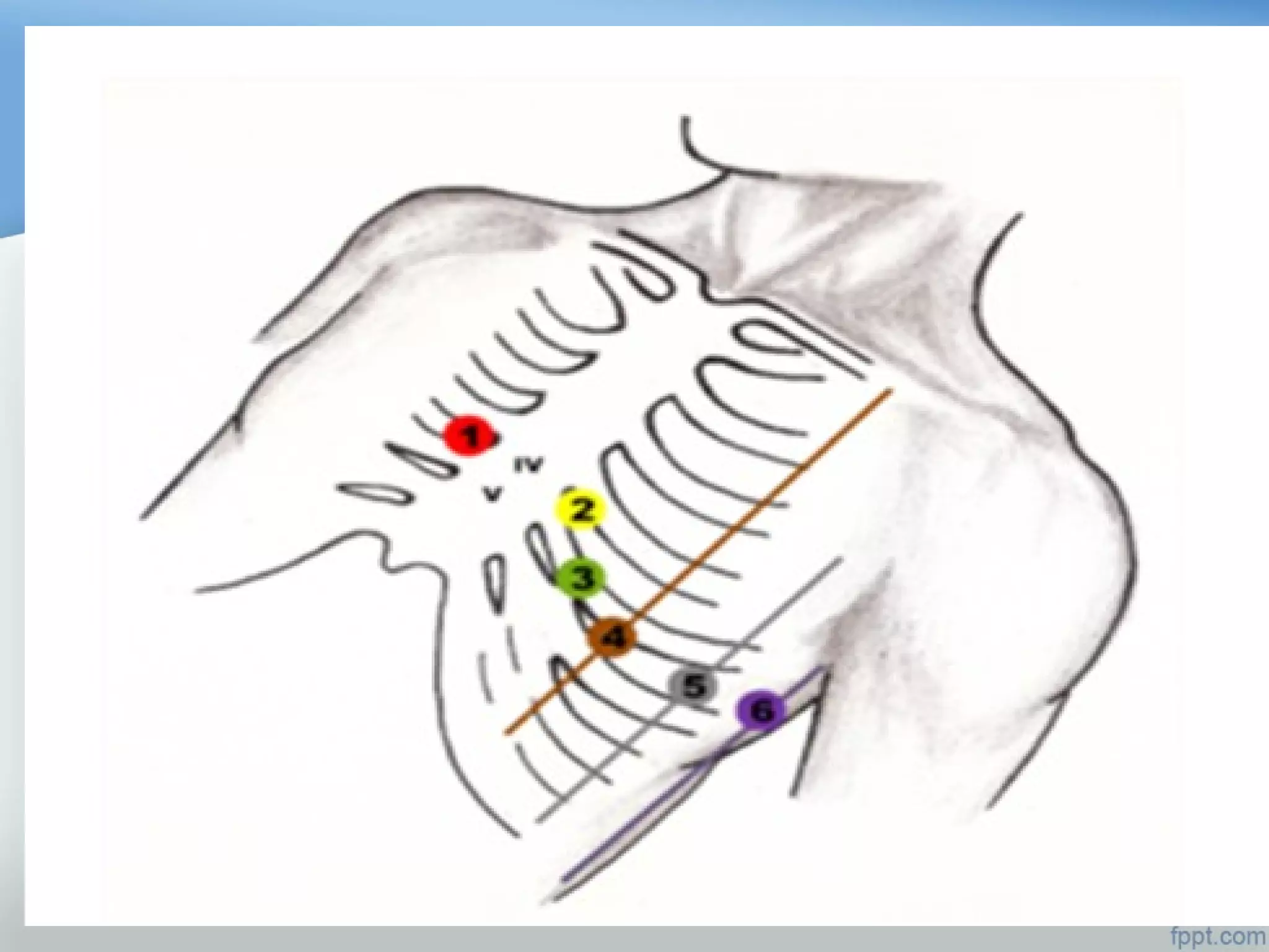 BASICS OF ECG