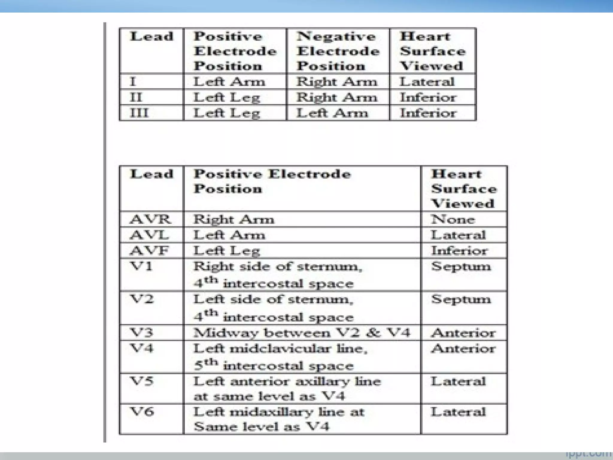 BASICS OF ECG