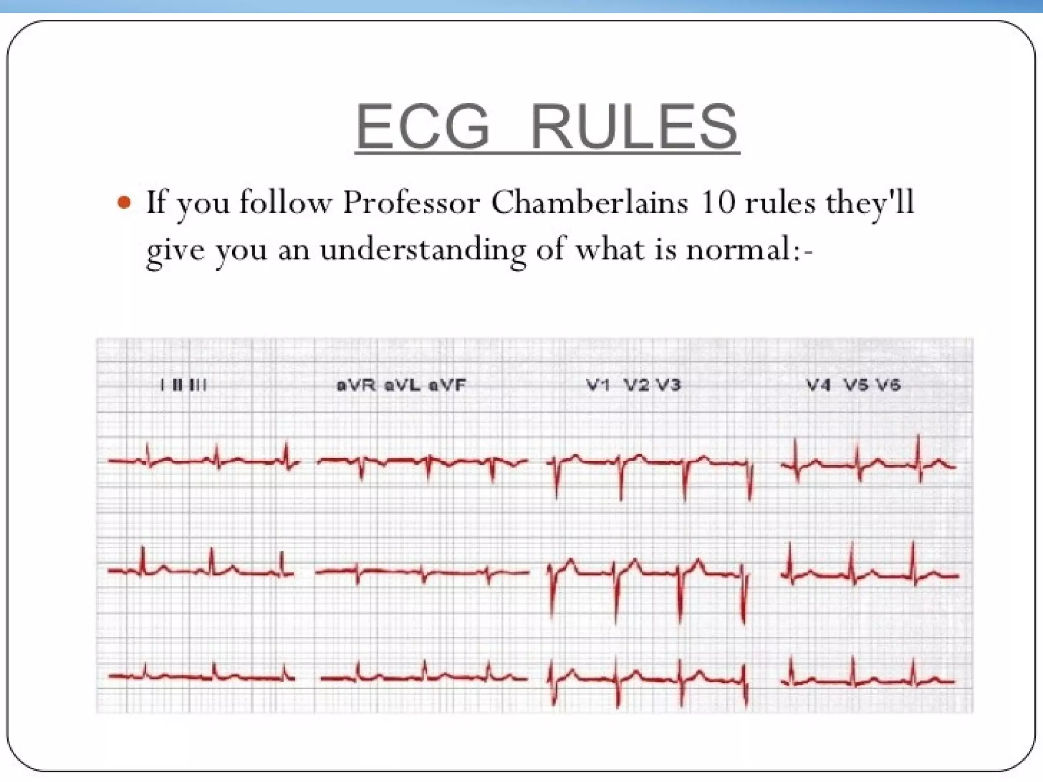 BASICS OF ECG