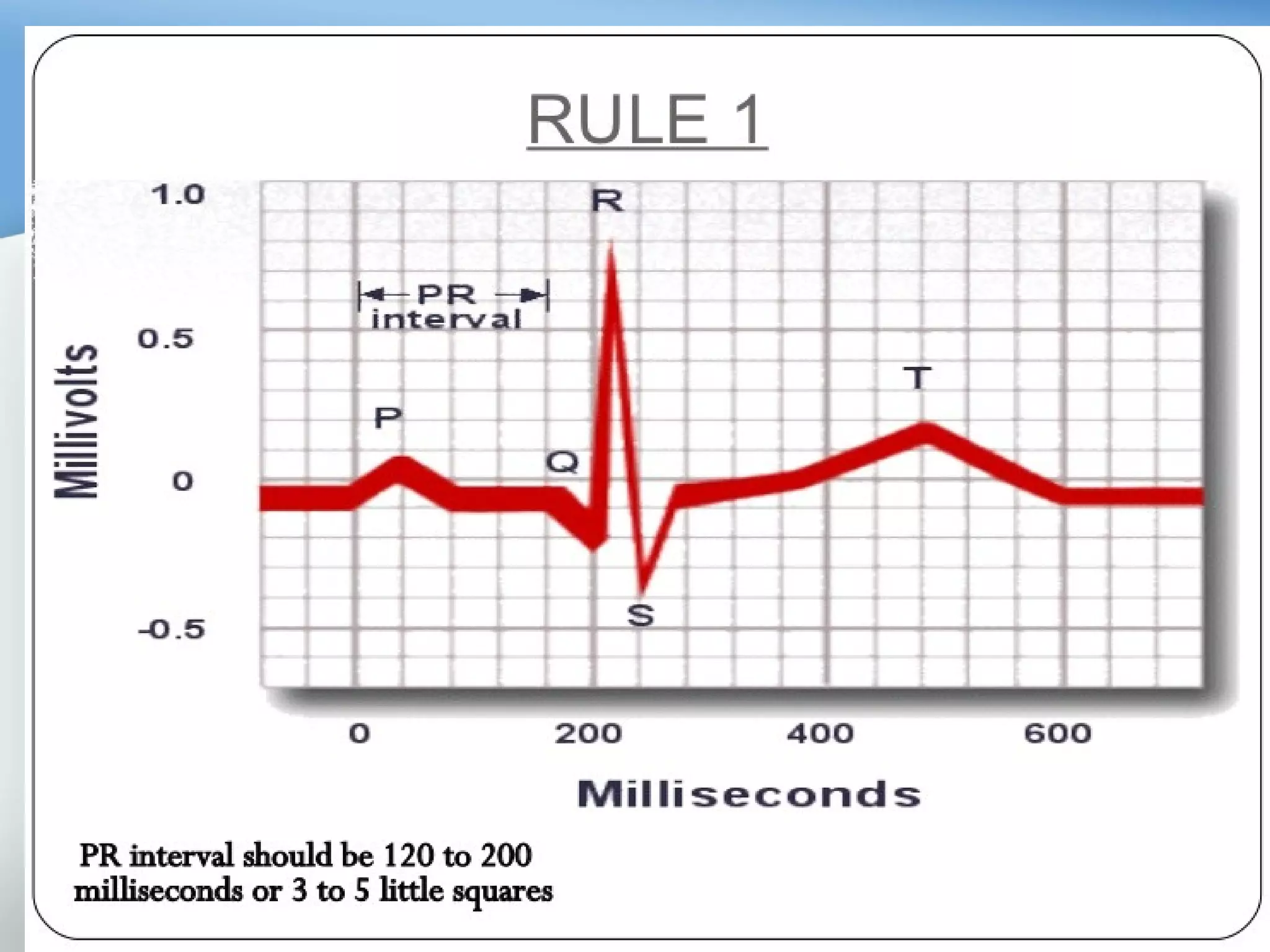 BASICS OF ECG