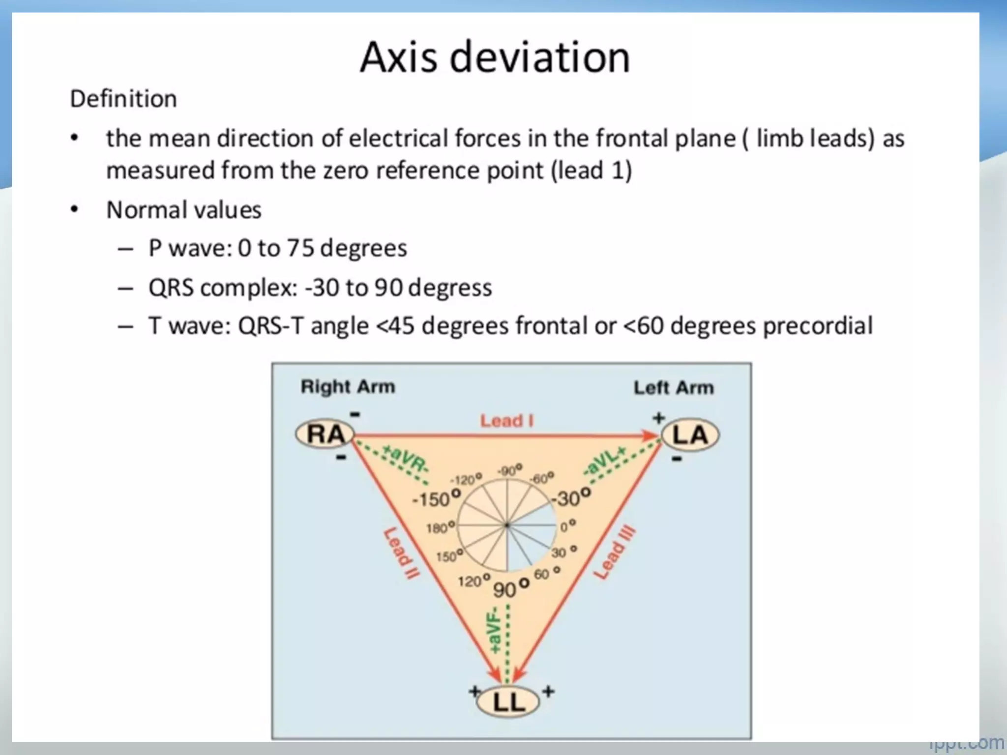 BASICS OF ECG