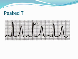 D R Sobuj ECG Basic.pptx, Dr. M.A. Sobuj Hayat, MBBS, BCS, D-Card(BSMMU) | PPTX