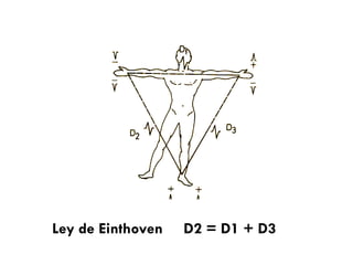 Ley de Einthoven D2 = D1 + D3
 