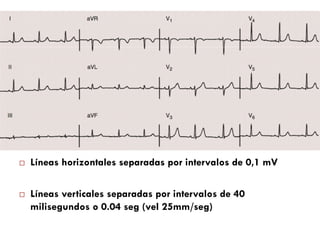 ¨  Líneas horizontales separadas por intervalos de 0,1 mV
¨  Líneas verticales separadas por intervalos de 40
milisegundos o 0.04 seg (vel 25mm/seg)
 
