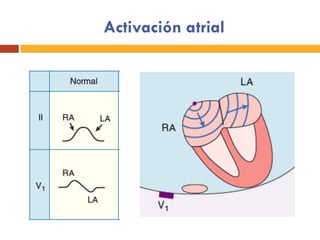 Activación atrial
 