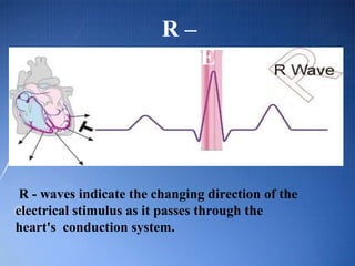 Two Consecutive R Waves Ecg basic guidelines | PPT