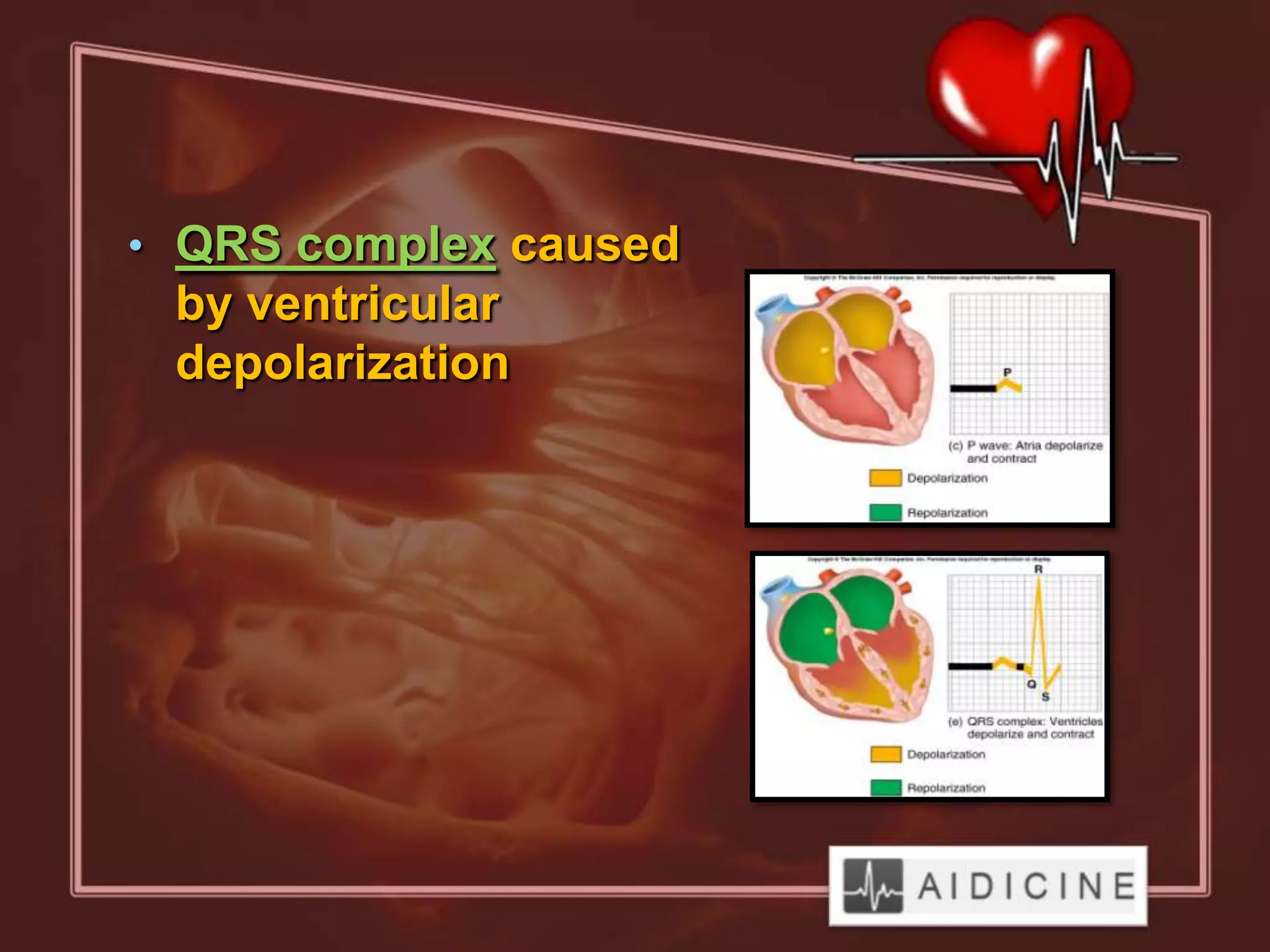 • QRS complex caused
 by ventricular
 depolarization
 