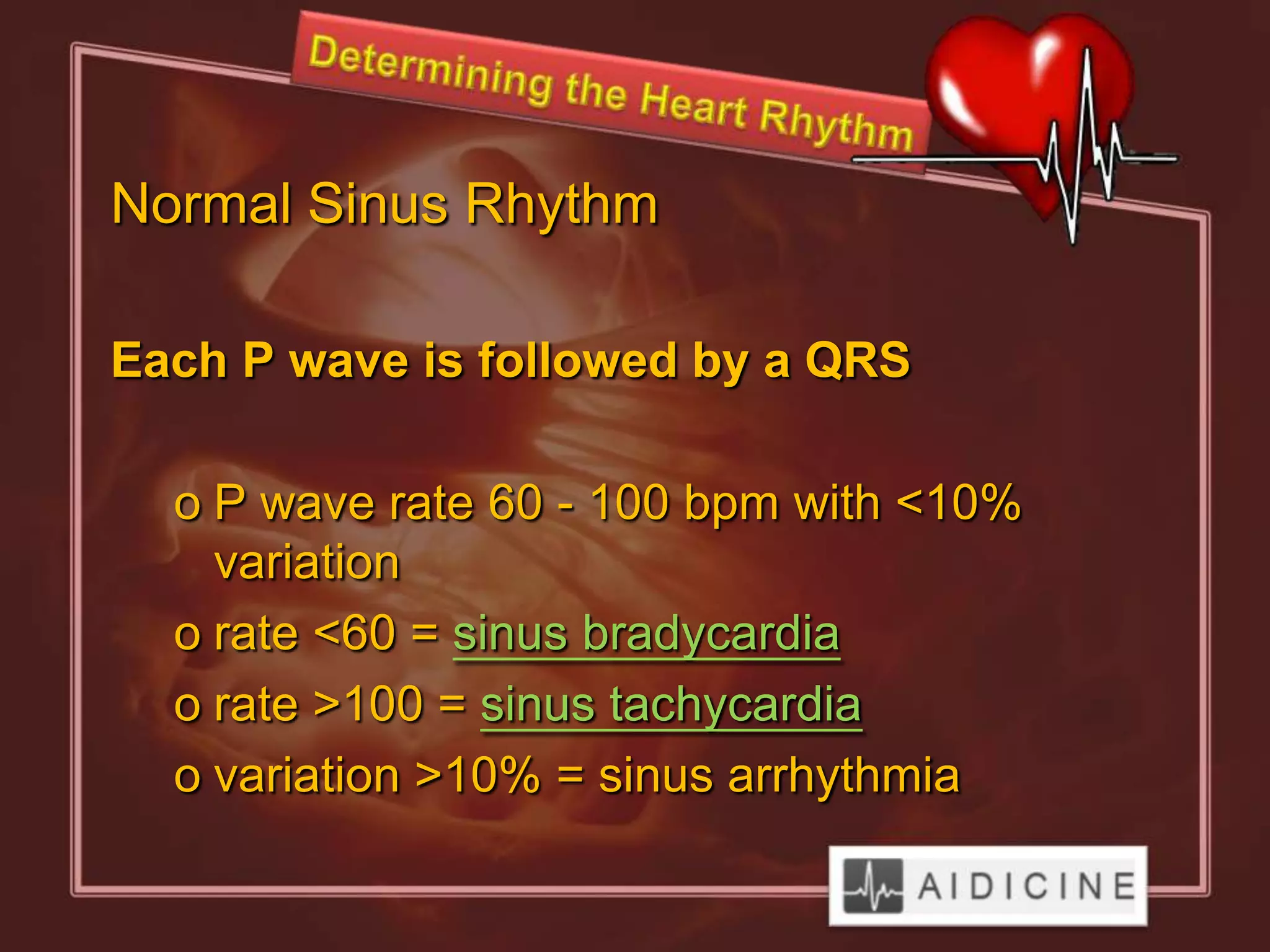Normal Sinus Rhythm

Each P wave is followed by a QRS

  o P wave rate 60 - 100 bpm with <10%
    variation
  o rate <60 = sinus bradycardia
  o rate >100 = sinus tachycardia
  o variation >10% = sinus arrhythmia
 