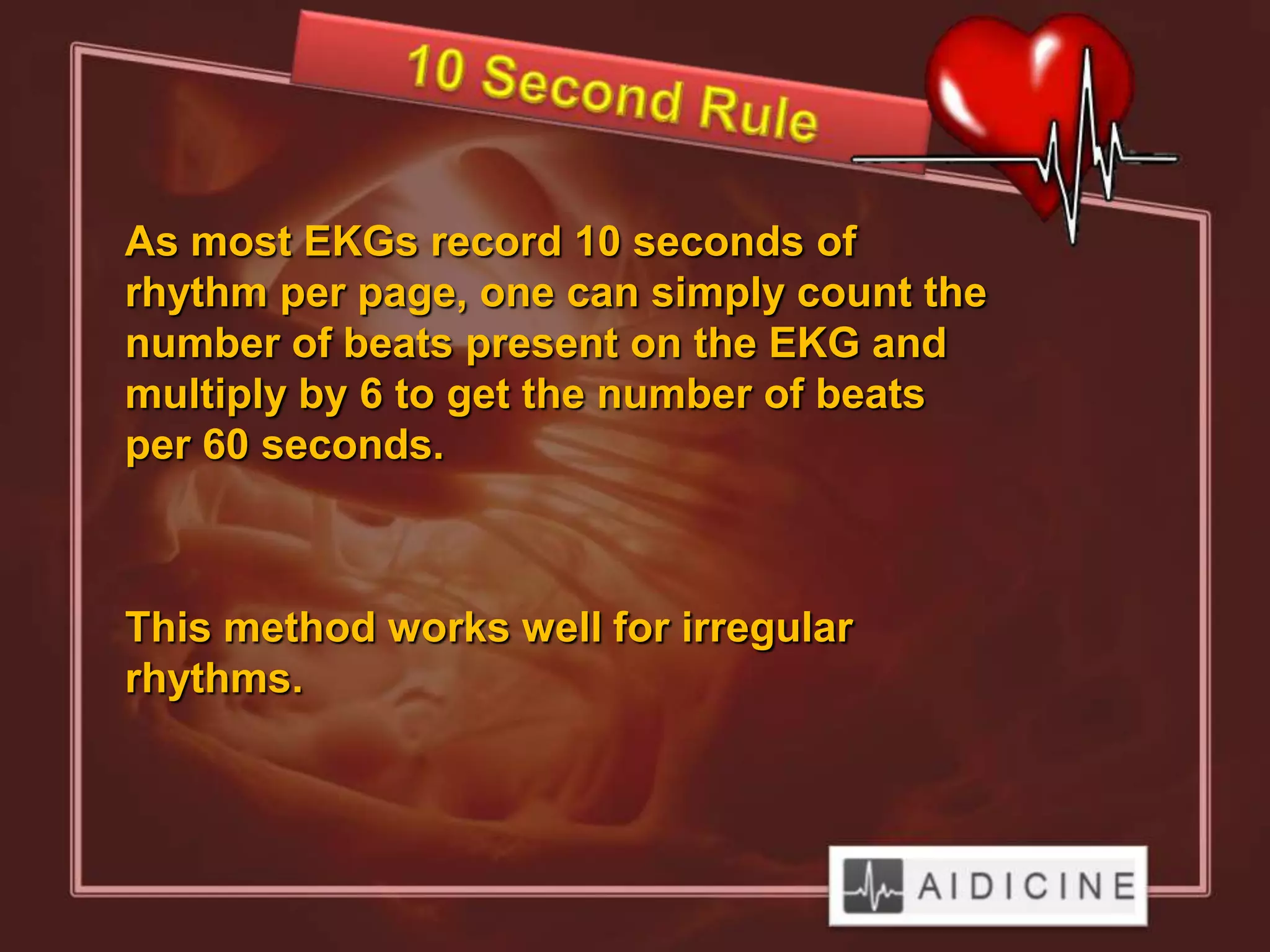 As most EKGs record 10 seconds of
rhythm per page, one can simply count the
number of beats present on the EKG and
multiply by 6 to get the number of beats
per 60 seconds.



This method works well for irregular
rhythms.
 
