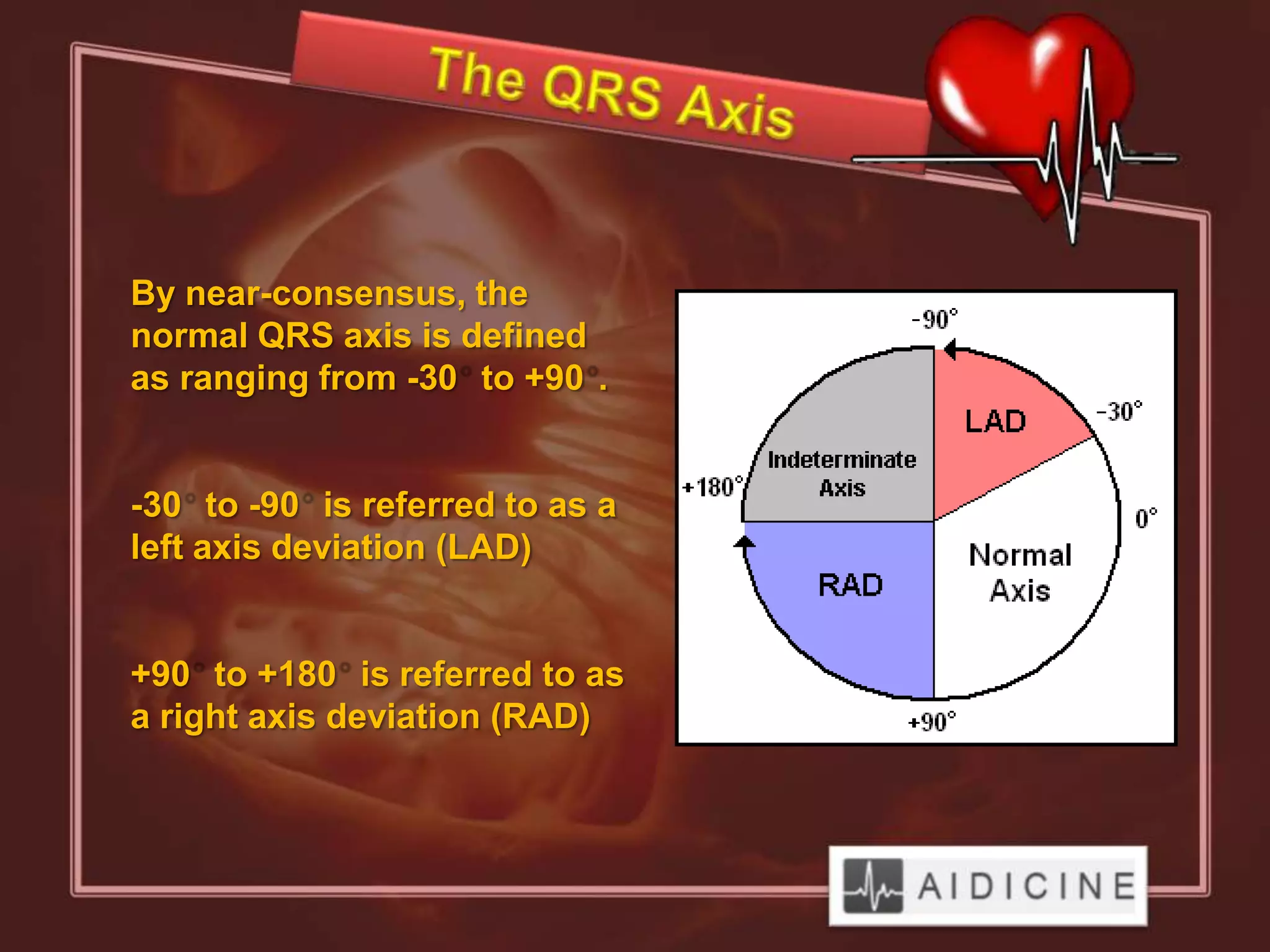 By near-consensus, the
normal QRS axis is defined
as ranging from -30 to +90 .


-30 to -90 is referred to as a
left axis deviation (LAD)


+90 to +180 is referred to as
a right axis deviation (RAD)
 
