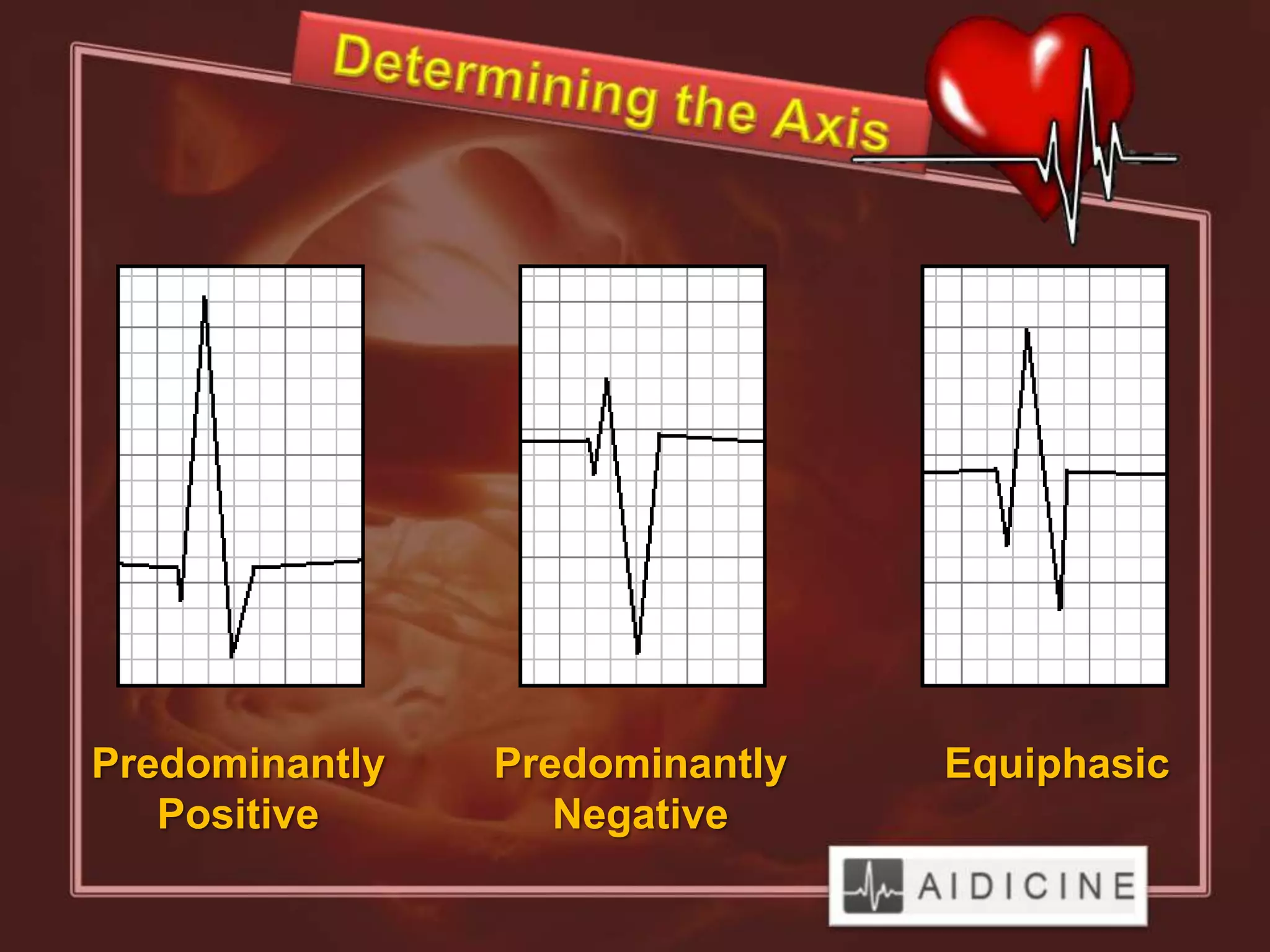 Predominantly   Predominantly   Equiphasic
   Positive        Negative
 