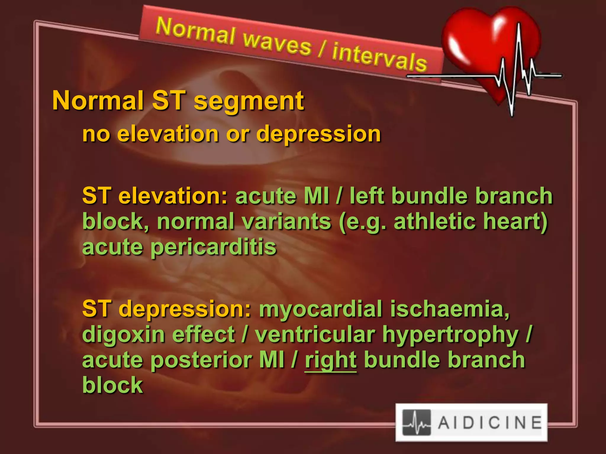Normal ST segment
  no elevation or depression

  ST elevation: acute MI / left bundle branch
  block, normal variants (e.g. athletic heart)
  acute pericarditis

  ST depression: myocardial ischaemia,
  digoxin effect / ventricular hypertrophy /
  acute posterior MI / right bundle branch
  block
 