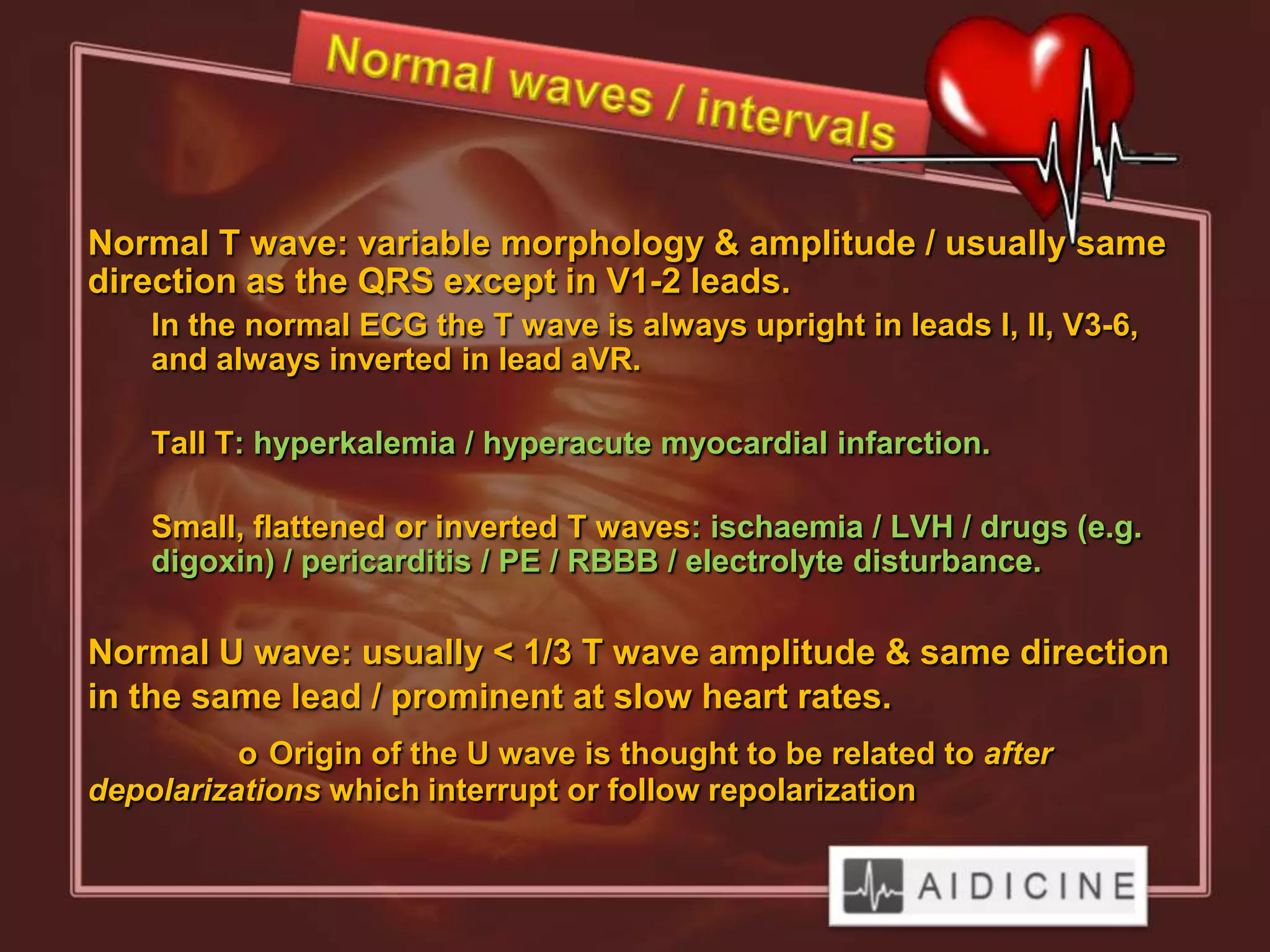 Normal T wave: variable morphology & amplitude / usually same
direction as the QRS except in V1-2 leads.
    In the normal ECG the T wave is always upright in leads I, II, V3-6,
    and always inverted in lead aVR.

    Tall T: hyperkalemia / hyperacute myocardial infarction.

    Small, flattened or inverted T waves: ischaemia / LVH / drugs (e.g.
    digoxin) / pericarditis / PE / RBBB / electrolyte disturbance.

Normal U wave: usually < 1/3 T wave amplitude & same direction
in the same lead / prominent at slow heart rates.
          o Origin of the U wave is thought to be related to after
depolarizations which interrupt or follow repolarization
 