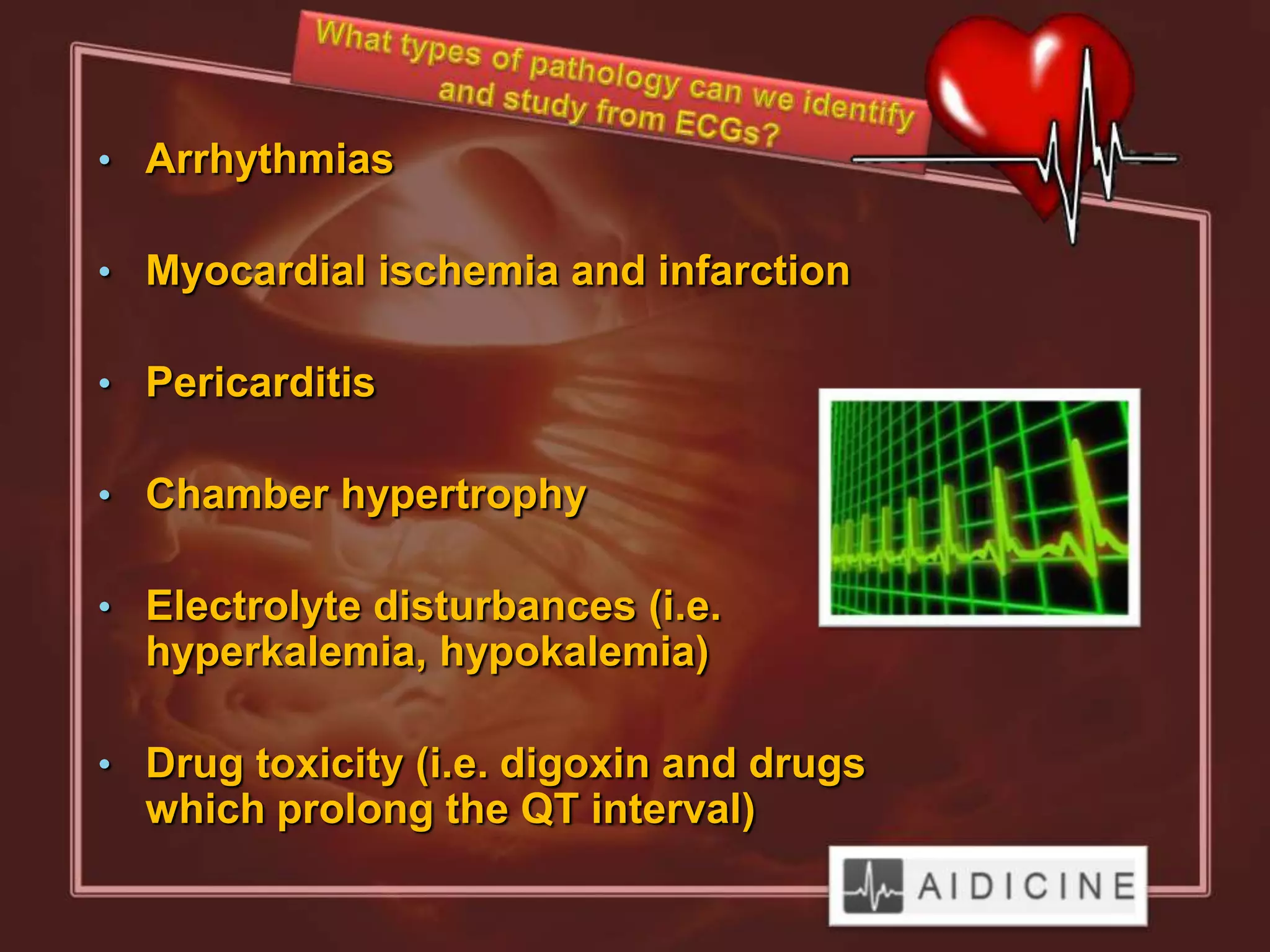 • Arrhythmias

• Myocardial ischemia and infarction

• Pericarditis

• Chamber hypertrophy

• Electrolyte disturbances (i.e.
  hyperkalemia, hypokalemia)

• Drug toxicity (i.e. digoxin and drugs
  which prolong the QT interval)
 