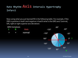 Ecg basics.ppts