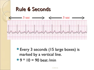 ECG Basics | PPT