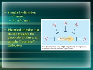 • Standard calibration
– 25 mm/s
– 0.1 mV/mm
• Electrical impulse that
travels towards the
electrode produces an
upright (“positive”)
deflection
 