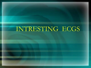 INTRESTING ECGS
 