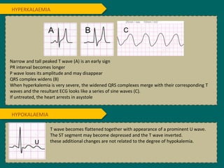 Narrow and tall peaked T wave (A) is an early sign
PR interval becomes longer
P wave loses its amplitude and may disappear
QRS complex widens (B)
When hyperkalemia is very severe, the widened QRS complexes merge with their corresponding T
waves and the resultant ECG looks like a series of sine waves (C).
If untreated, the heart arrests in asystole
T wave becomes flattened together with appearance of a prominent U wave.
The ST segment may become depressed and the T wave inverted.
these additional changes are not related to the degree of hypokalemia.
HYPERKALAEMIA
HYPOKALAEMIA
 