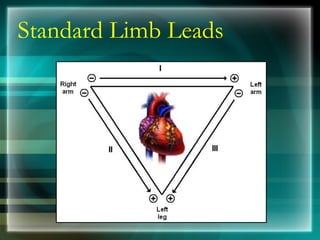 Standard Limb Leads
 