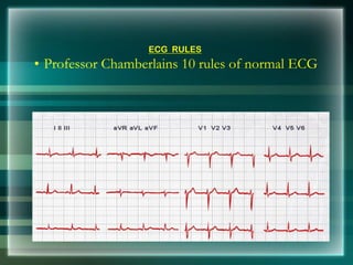 ECG RULES
• Professor Chamberlains 10 rules of normal ECG
 