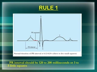 RULE 1
PR interval should be 120 to 200 milliseconds or 3 to
5 little squares
 