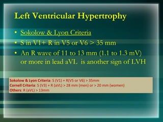 Left Ventricular Hypertrophy
• Sokolow & Lyon Criteria
• S in V1+ R in V5 or V6 > 35 mm
• An R wave of 11 to 13 mm (1.1 to 1.3 mV)
or more in lead aVL is another sign of LVH
Sokolow & Lyon Criteria: S (V1) + R(V5 or V6) > 35mm
Cornell Criteria: S (V3) + R (aVL) > 28 mm (men) or > 20 mm (women)
Others: R (aVL) > 13mm
 