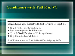 Conditions with Tall R in V1
 