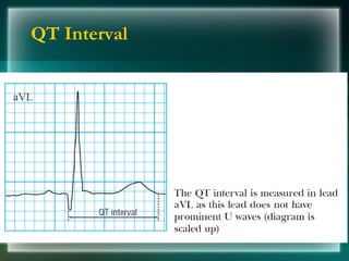 QT Interval
 