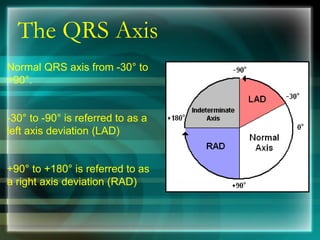 The QRS Axis
Normal QRS axis from -30° to
+90°.
-30° to -90° is referred to as a
left axis deviation (LAD)
+90° to +180° is referred to as
a right axis deviation (RAD)
 