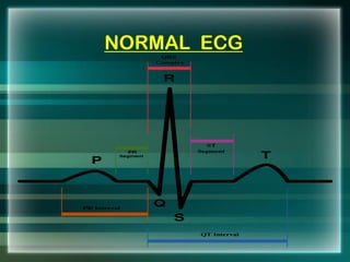 NORMAL ECG
 