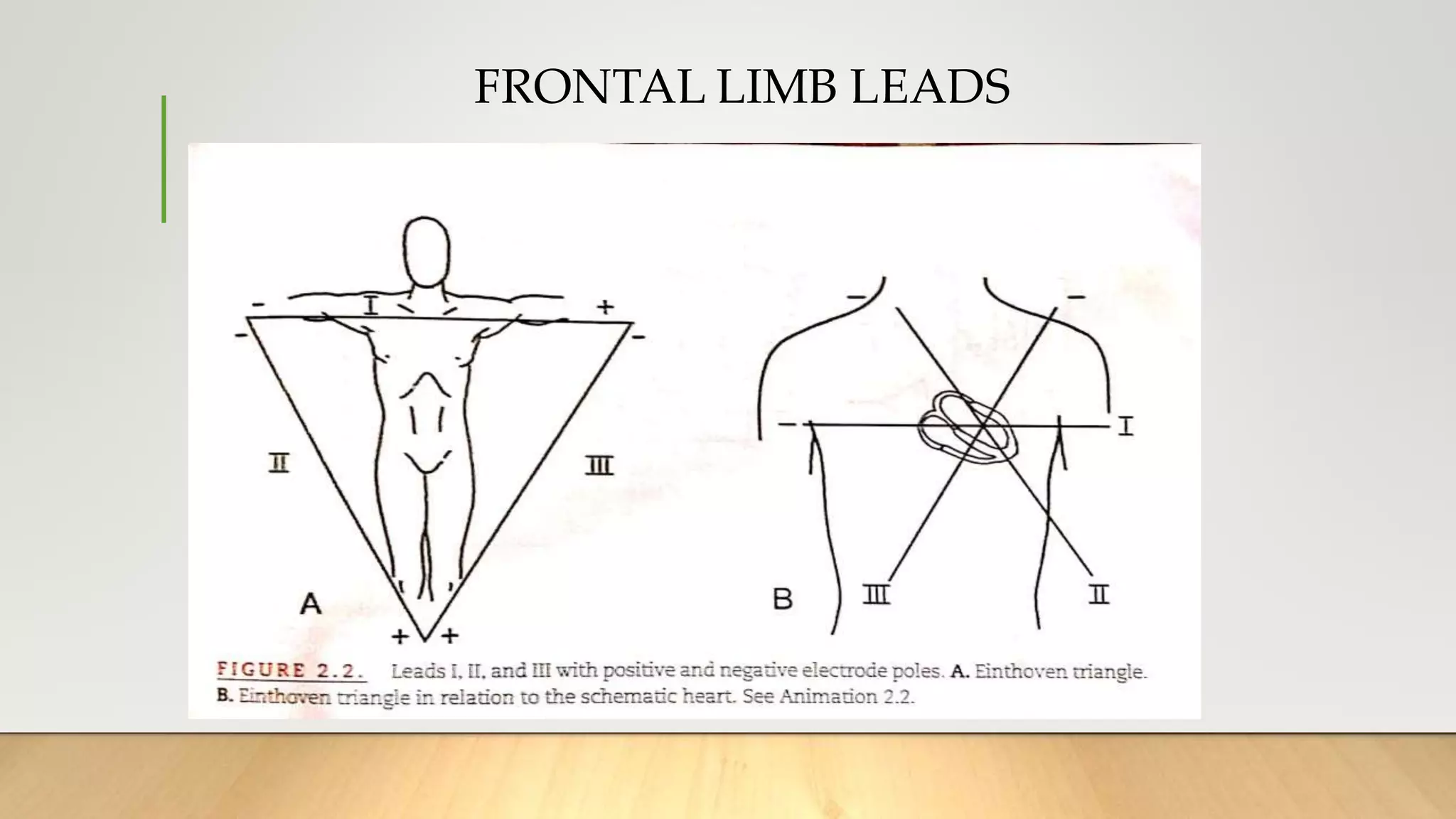 FRONTAL LIMB LEADS
 