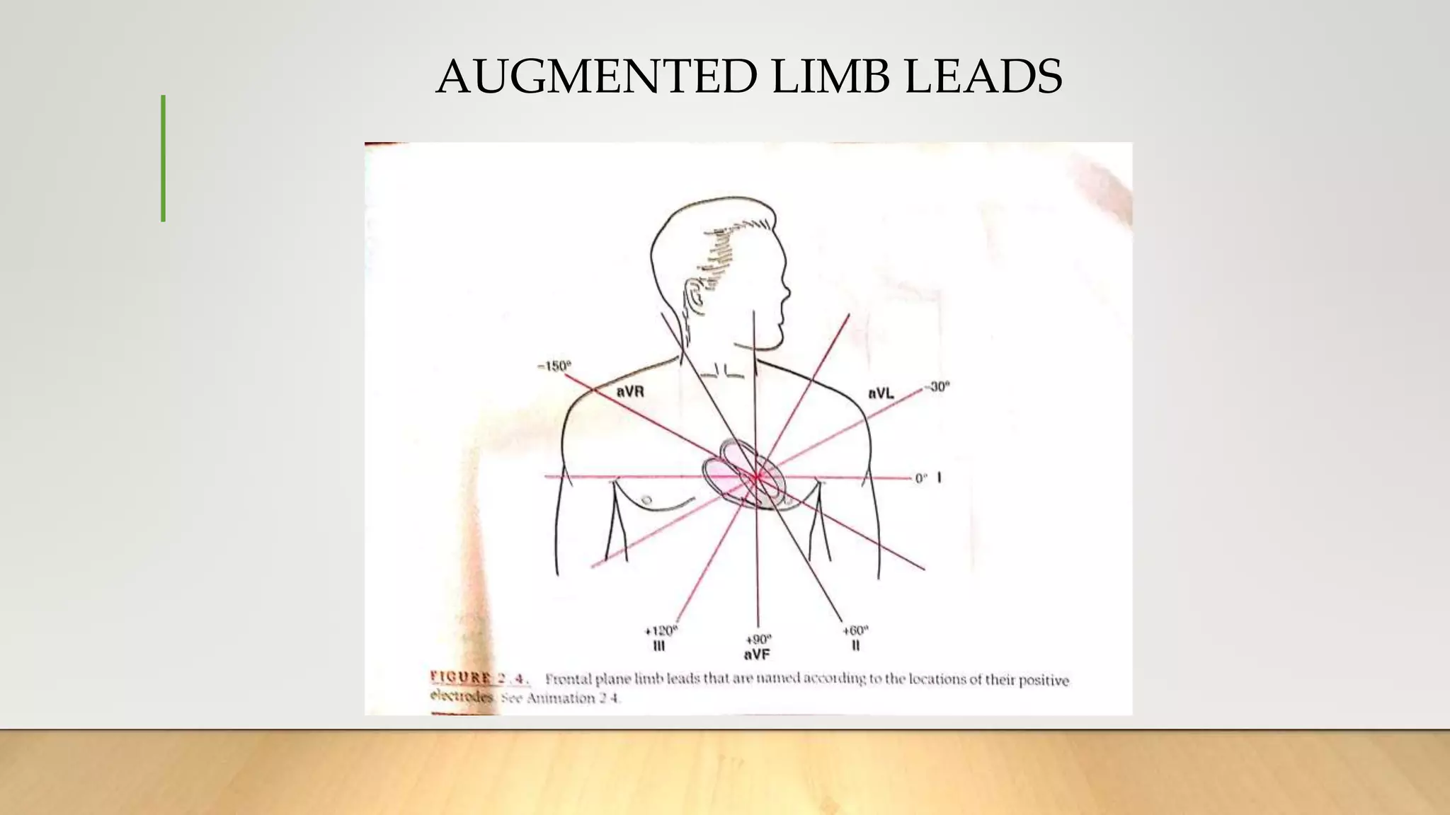 AUGMENTED LIMB LEADS
 