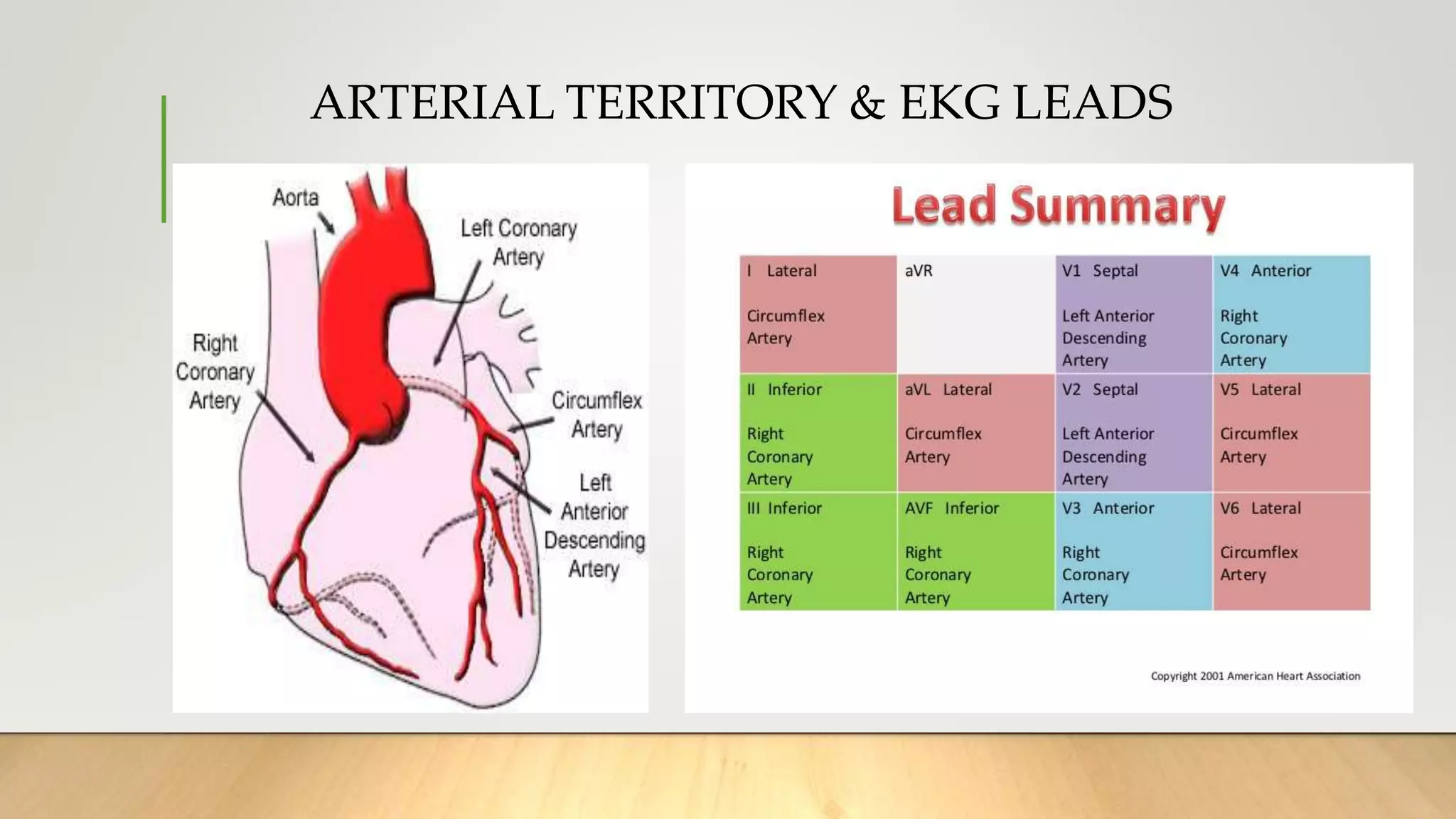 ARTERIAL TERRITORY & EKG LEADS
 