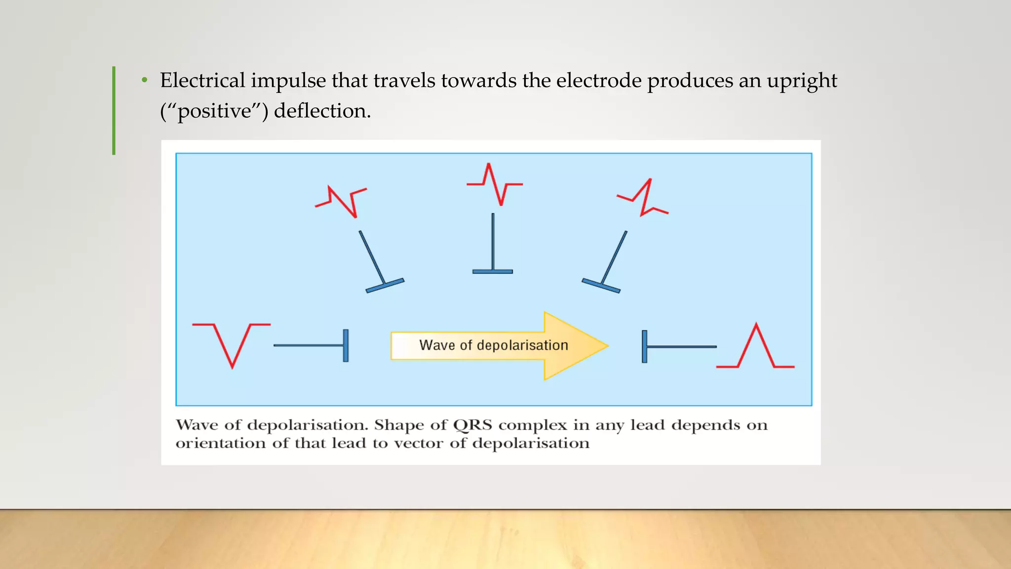 • Electrical impulse that travels towards the electrode produces an upright
(“positive”) deflection.
 