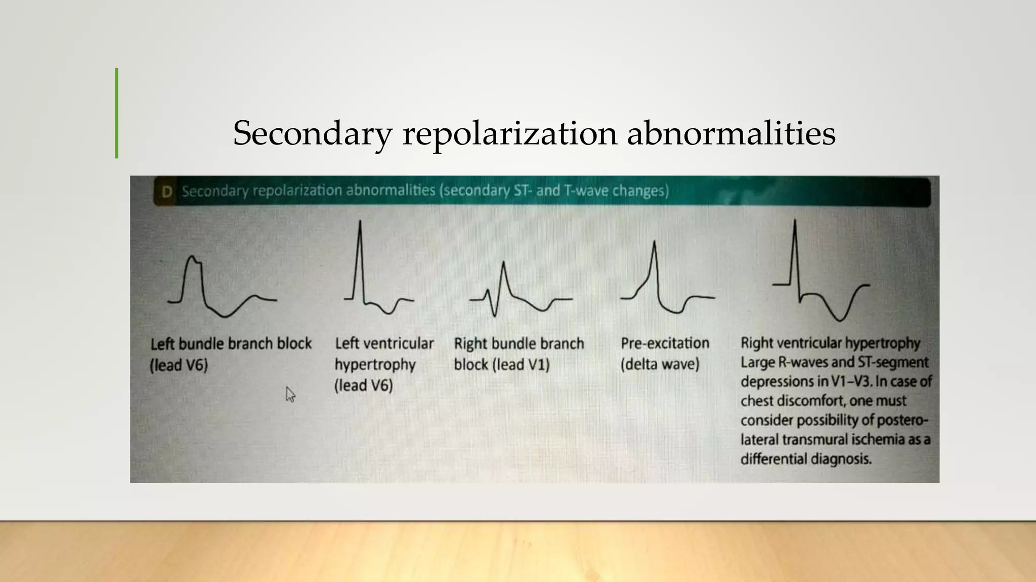 Secondary repolarization abnormalities
 