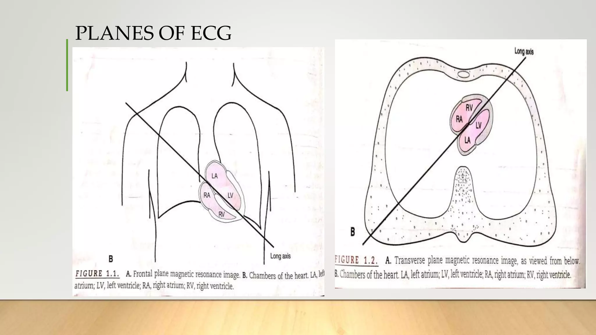 PLANES OF ECG
 