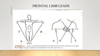 FRONTAL LIMB LEADS
 