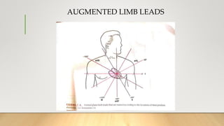 AUGMENTED LIMB LEADS
 