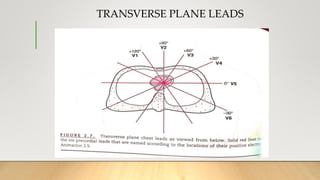 TRANSVERSE PLANE LEADS
 