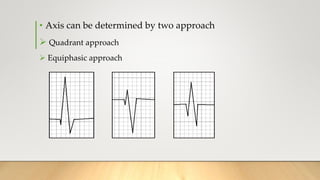 • Axis can be determined by two approach
 Quadrant approach
 Equiphasic approach
 