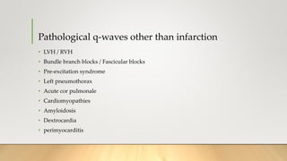 Pathological q-waves other than infarction
• LVH / RVH
• Bundle branch blocks / Fascicular blocks
• Pre-excitation syndrome
• Left pneumothorax
• Acute cor pulmonale
• Cardiomyopathies
• Amyloidosis
• Dextrocardia
• perimyocarditis
 