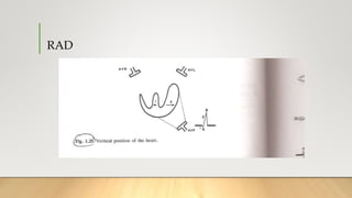 RAD
 