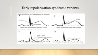 Early repolarization syndrome variants
 
