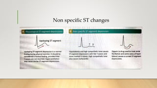 Non specific ST changes
 