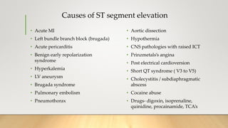 Causes of ST segment elevation
• Acute MI
• Left bundle branch block (brugada)
• Acute pericarditis
• Benign early repolarization
syndrome
• Hyperkalemia
• LV aneurysm
• Brugada syndrome
• Pulmonary embolism
• Pneumothorax
• Aortic dissection
• Hypothermia
• CNS pathologies with raised ICT
• Prinzmetals’s angina
• Post electrical cardioversion
• Short QT syndrome ( V3 to V5)
• Cholecystitis / subdiaphragmatic
abscess
• Cocaine abuse
• Drugs- digoxin, isoprenaline,
quinidine, procainamide, TCA’s
 