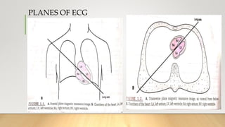 PLANES OF ECG
 
