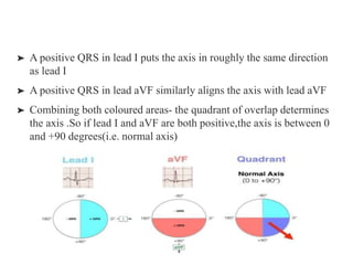 Ecg basics | PPT